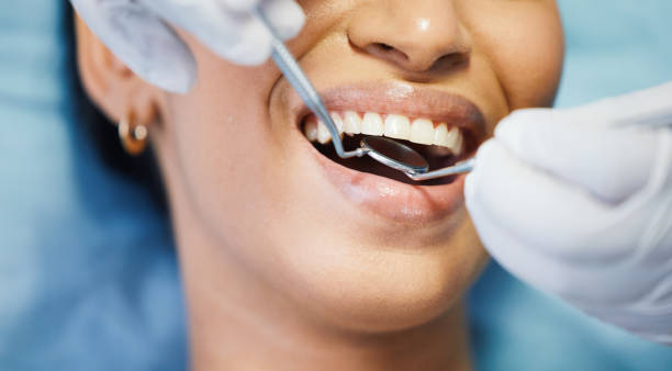 Best Walk-In Dentist Near Me  in Key Center, WA